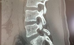 分離症1.JPG